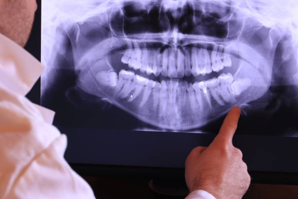 Best Emergency Gum Treatment in West Haven, UT